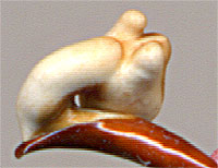  Carabus kolymensis
