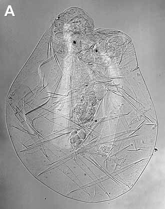 Общий вид беспанцирной коловратки Asplanchna priodonta