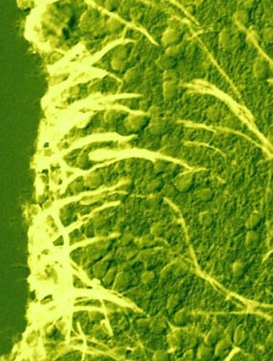 Иммуногистохимическое выявление ароматазы В в клетках радиальной глии в субвентрикулярной области промежуточного мозга лосося