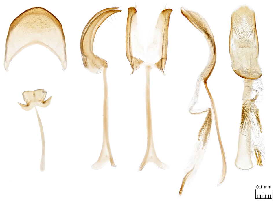 3_Edolosa_male_genitalia
