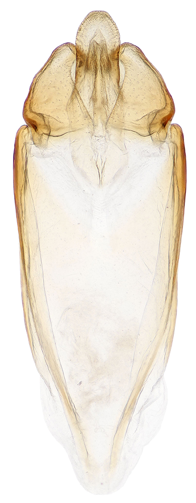 Mataeopsephus_japonicus_D_male_genitalia