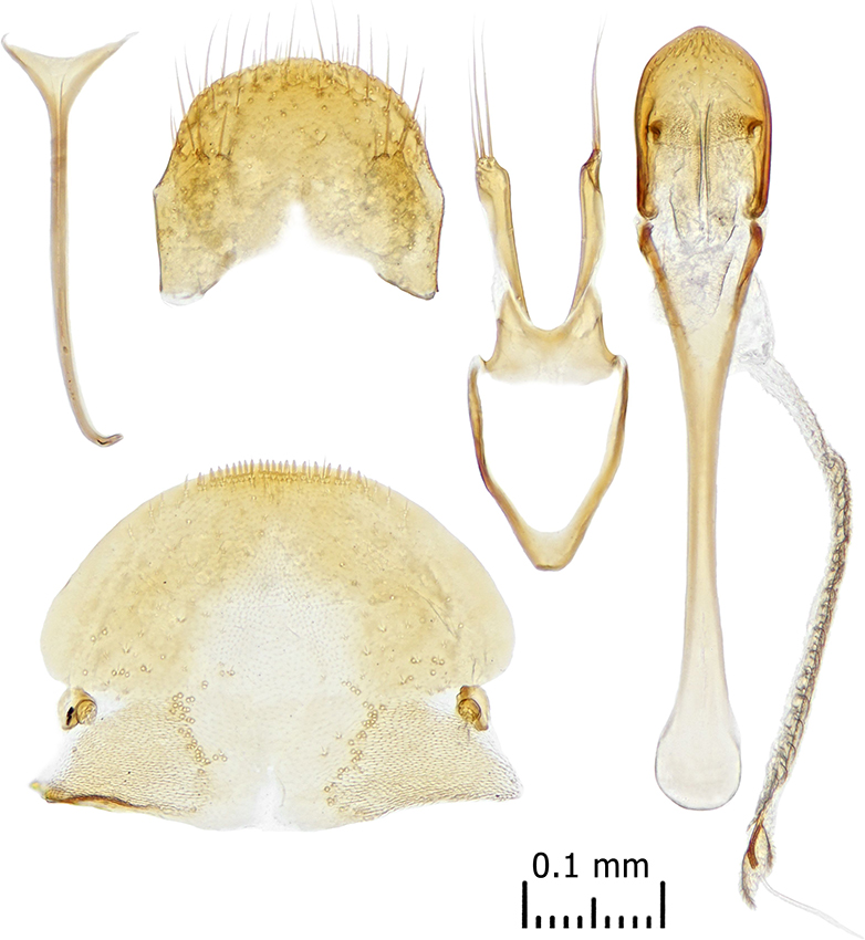 Silvanolomus_brevis_A_male_genitalia_x20