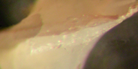 morpha CD2
