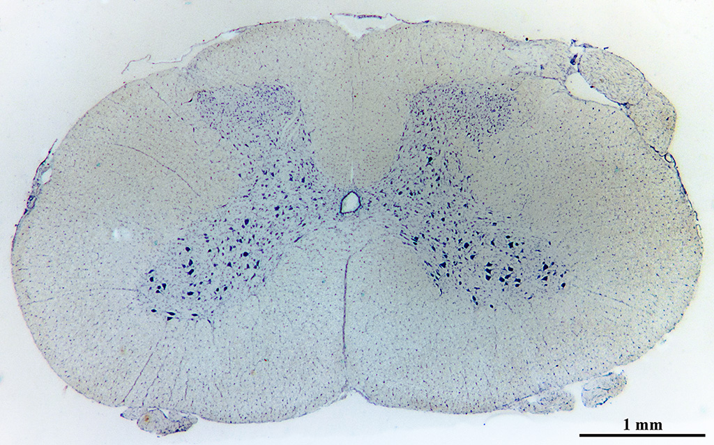 Вещество препарат. Спинной мозг гистология препарат. Окраска по Нисслю гистология. Поперечный разрез спинного мозга окраска по Нисслю.